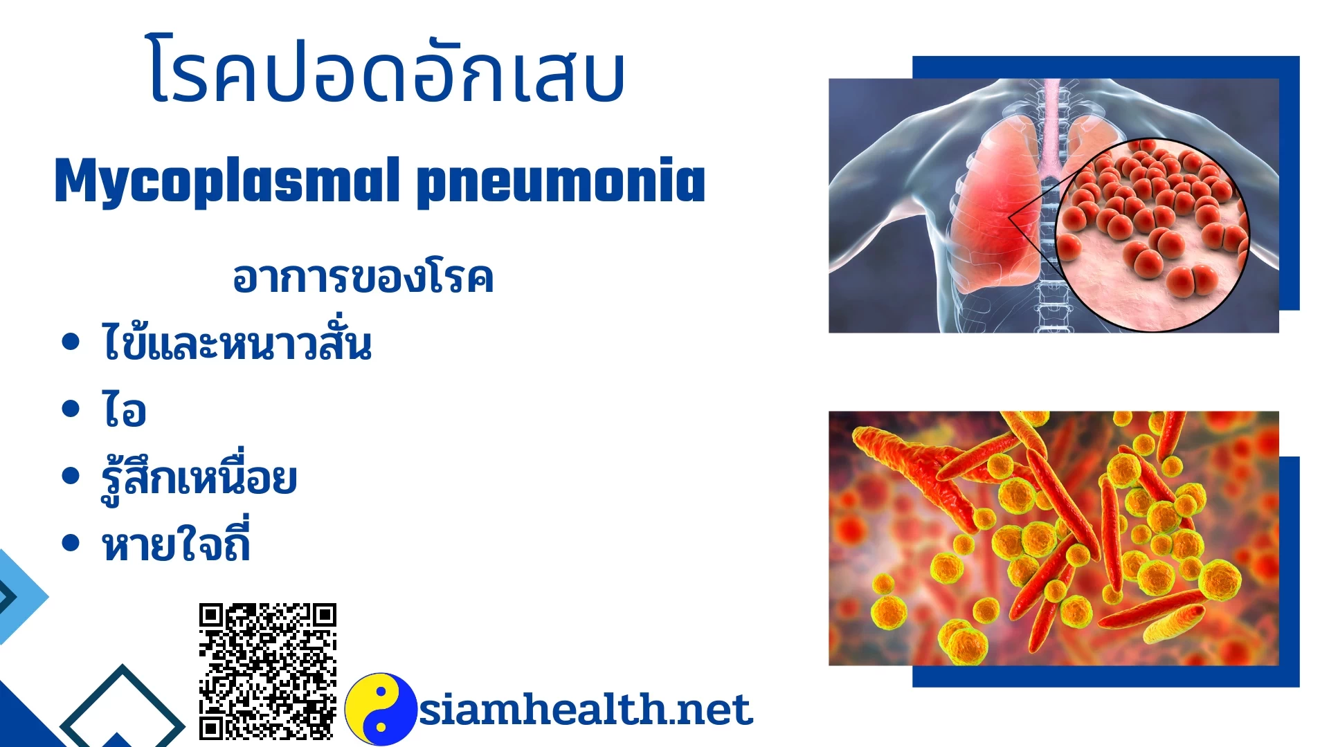 โรคปอดอักเสบ Mycoplasmal pneumonia